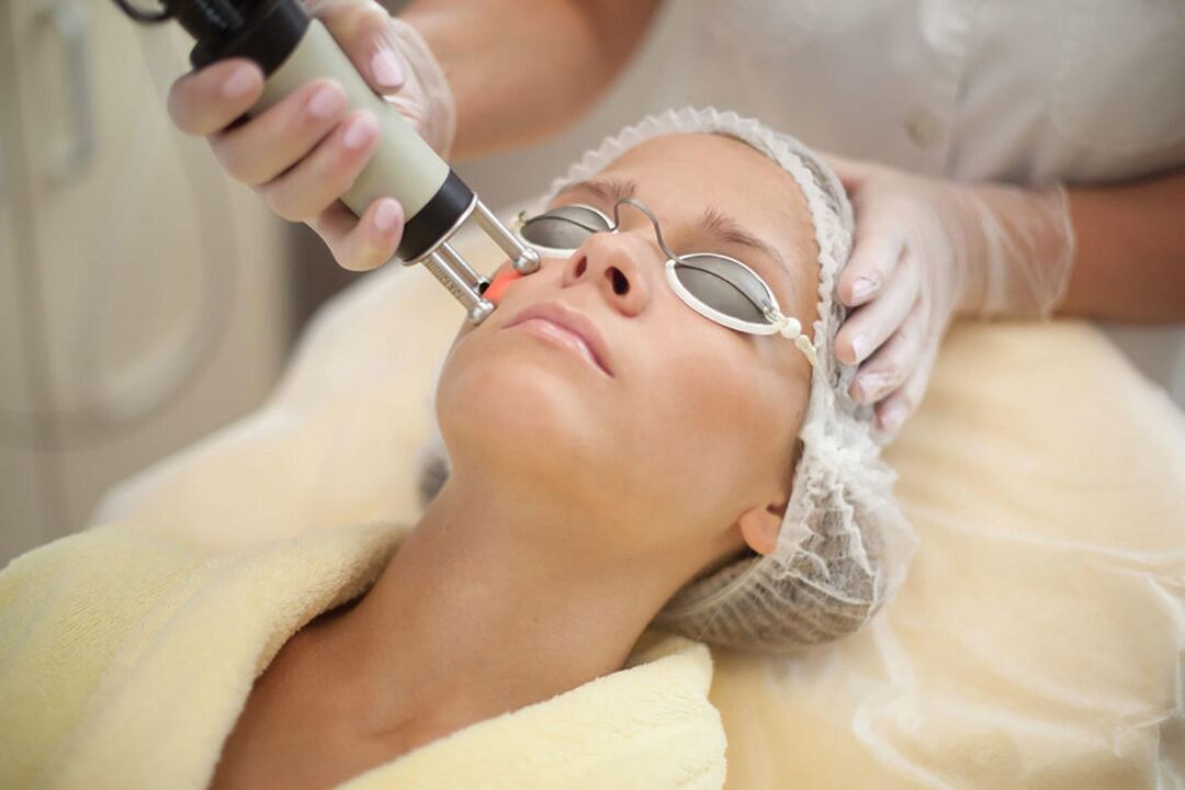 laser facial rejuvenation who