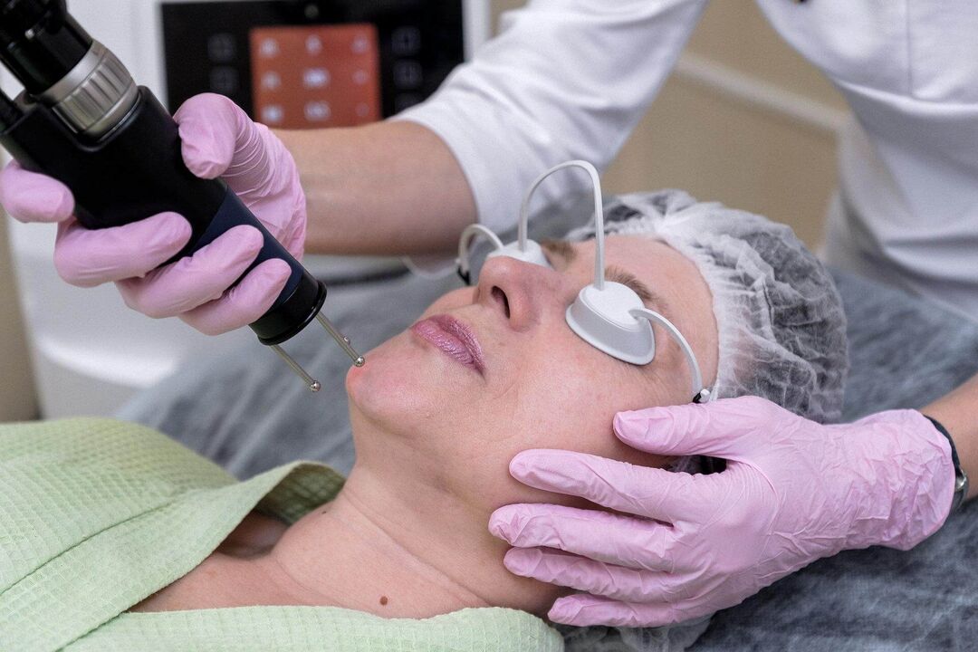 Ablative laser procedure for skin rejuvenation